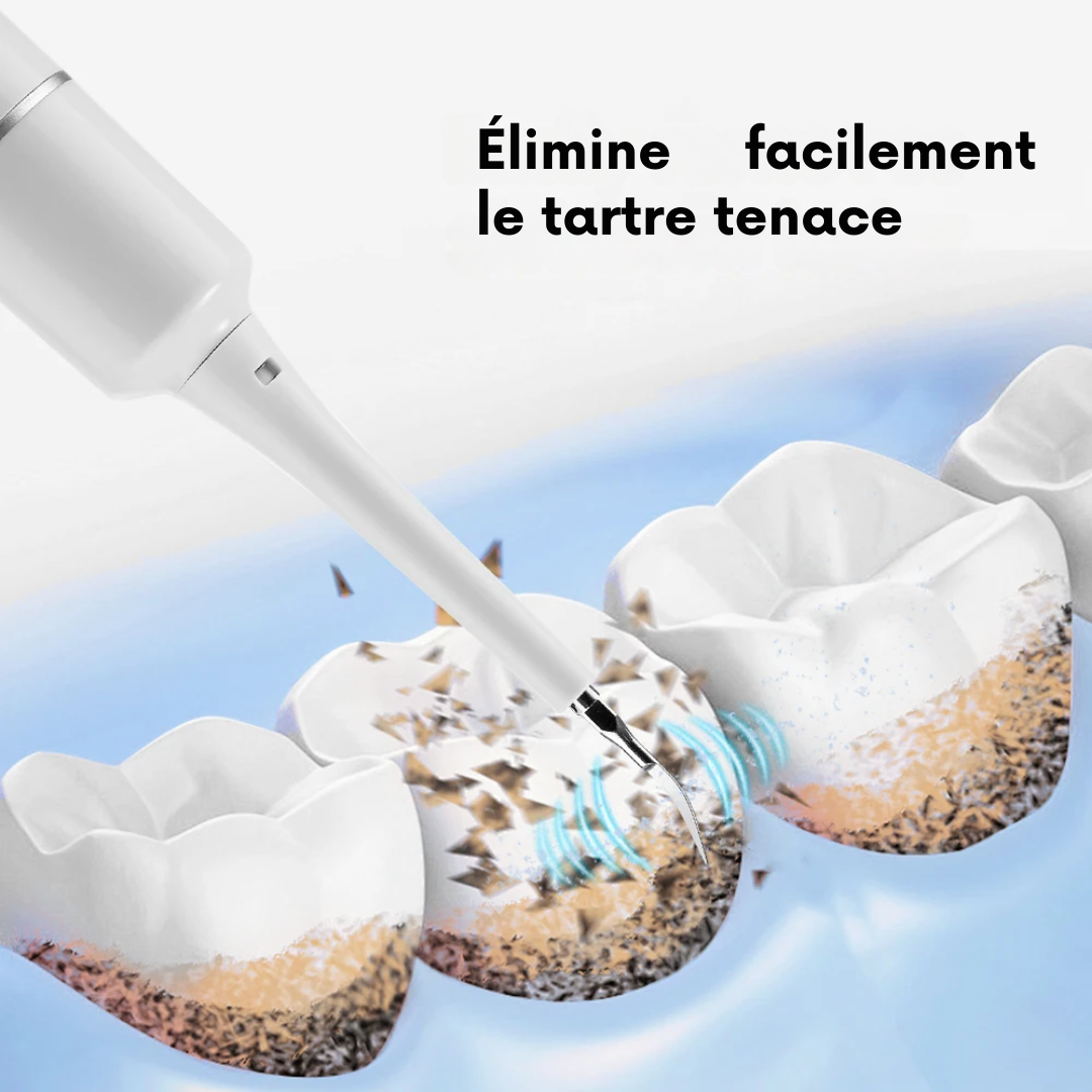 Détartreur Dentaire à Ultrasons BuccoDétartreur™ - Nettoyage Professionnel