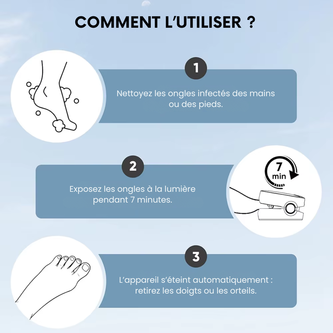 Laser Nettoyant pour Champignons des Ongles – Mains et Pieds
