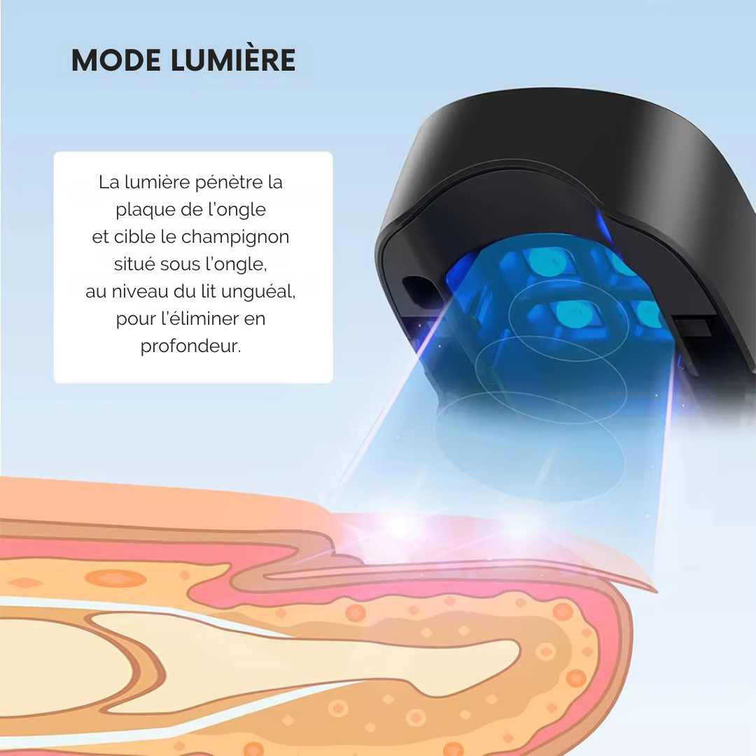 Laser Nettoyant pour Champignons des Ongles – Mains et Pieds