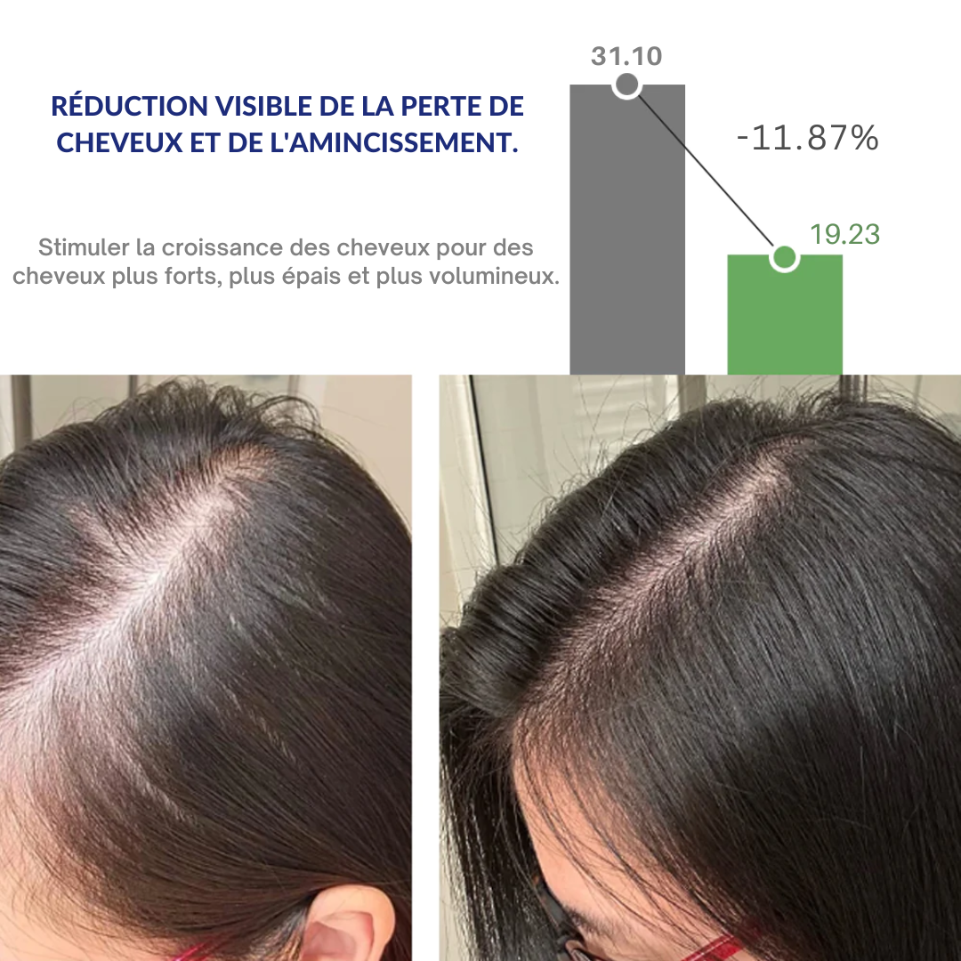 Brosse Capillaire Stimulante Tout-en-un pour Croissance et Vitalité des Cheveux CareThérapie™